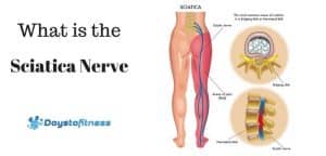 What is sciatica nerve post cover