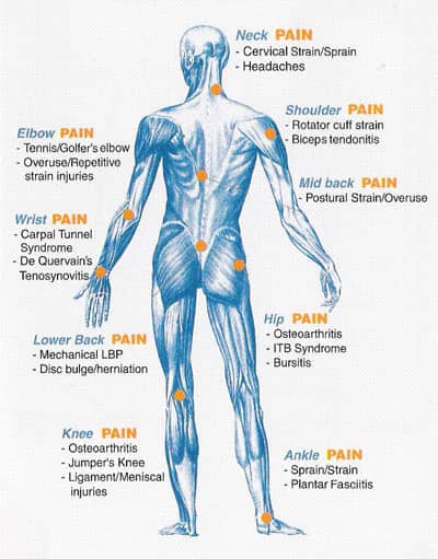nerve pain symptoms