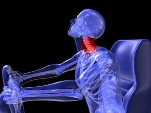 car accidents neck pain